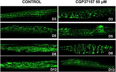 The Mitochondrial Na+/Ca2+ Exchanger Inhibitor CGP37157 Preserves Muscle Structure and Function to Increase Lifespan and Healthspan in Caenorhabditis elegans